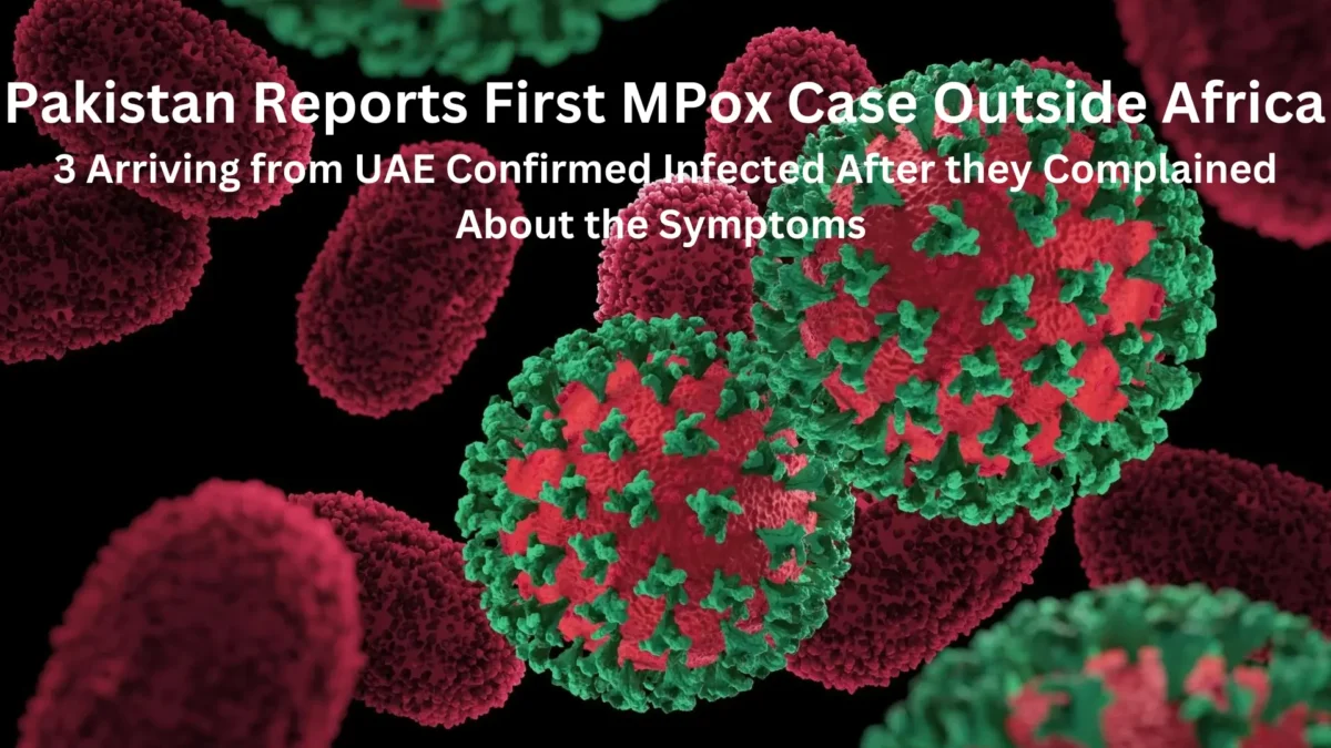 Microscopic view of the Mpox virus, marking the first mpox case outside Africa