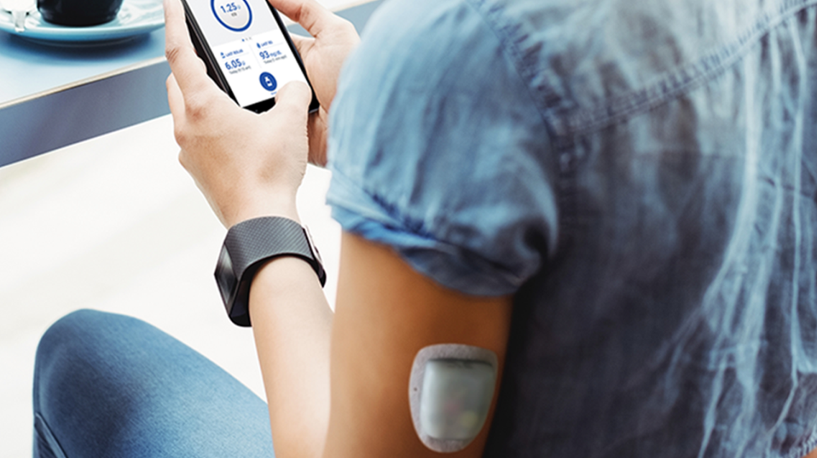 Tubeless insulin pump market growth forecast