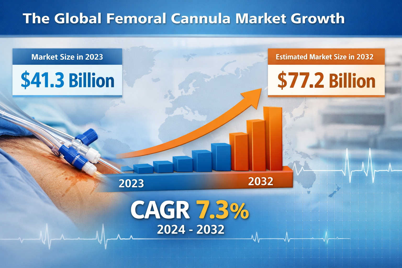 Femoral Cannula Market