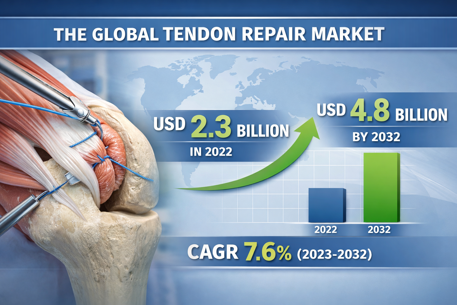 Tendon Repair Market