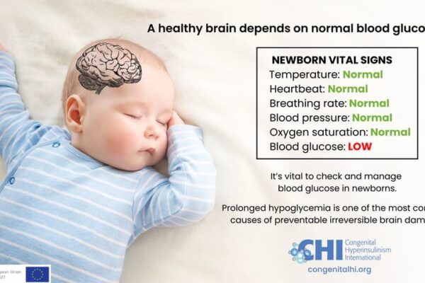 Congenital Hyperinsulinism Treatment Market