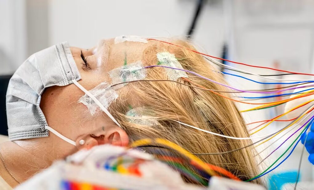 Epilepsy Surgery Market