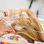 Epilepsy Surgery Market