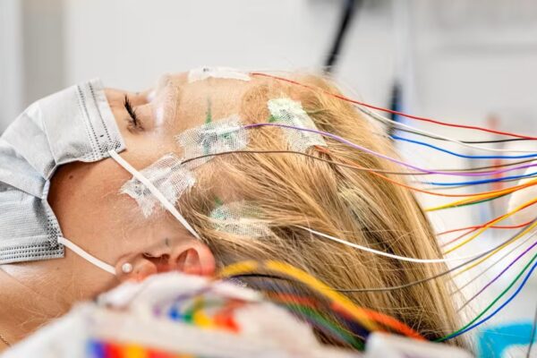 Epilepsy Surgery Market