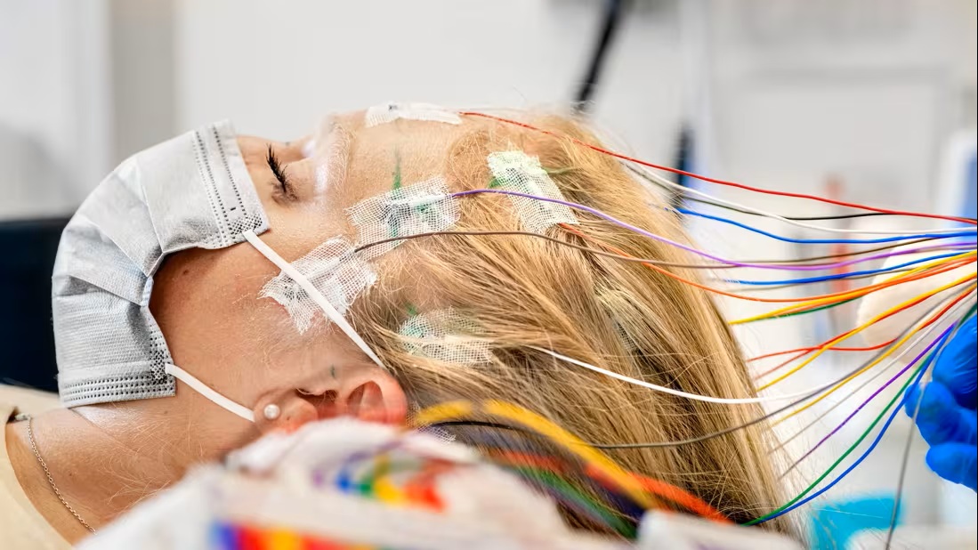 Epilepsy Surgery Market