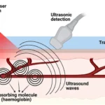Photoacoustic Imaging Market