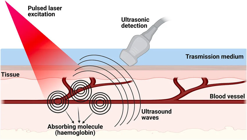 Photoacoustic Imaging Market