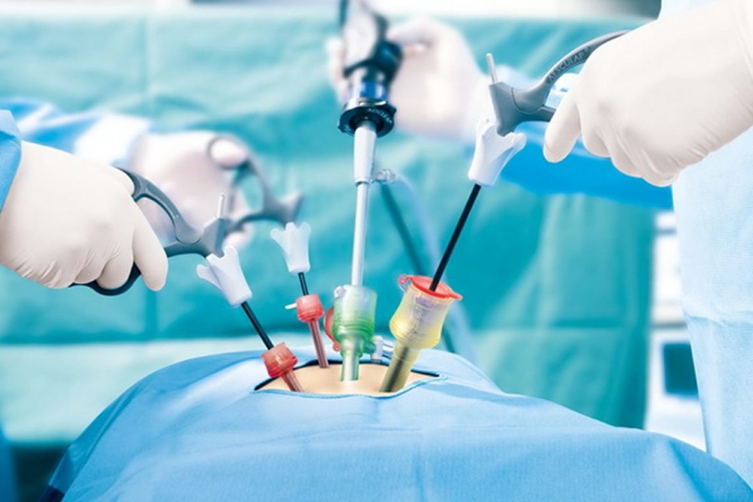 Bariatric Surgery Devices Market Revenue, Trends, and Strategic Insights by 2032 2 Bariatric Surgery Devices Market