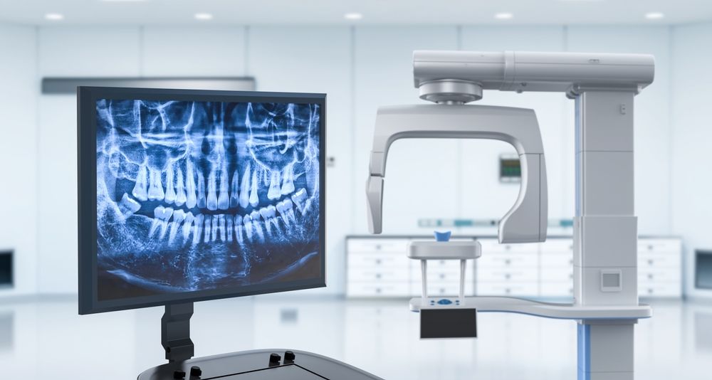 Dental Digital X-Ray Market