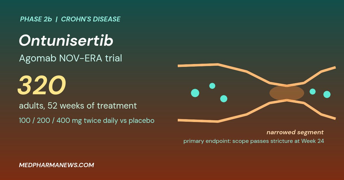Graphic: ontunisertib Crohn's disease Phase 2b trial, a narrowed intestinal segment with a stricture and the NOV-ERA 320 adults 52 weeks label